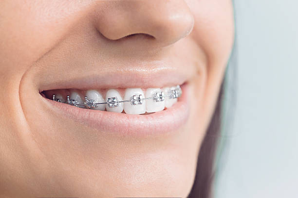 Dental Inlays and Onlays in Cameron, WI